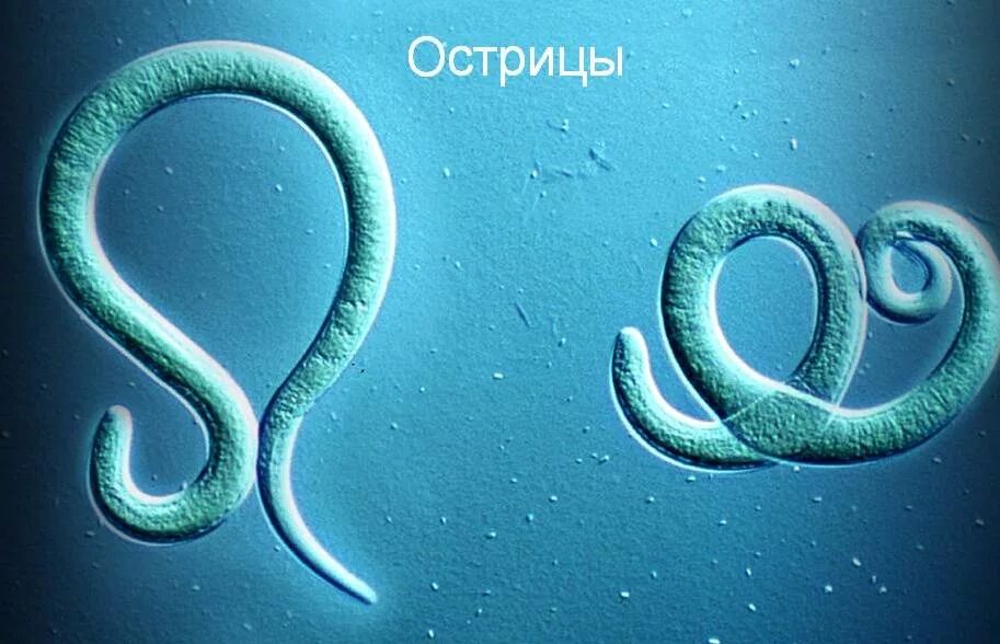 Острицы паразиты млекопитающих. Гельминтозы энтеробиоз. острицы фото под микроскопом для детей.