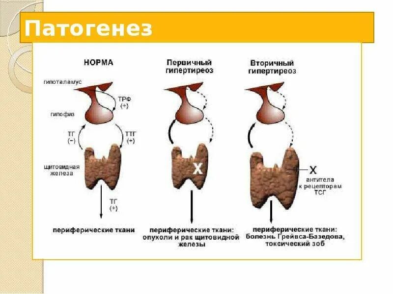 Гипофункция щитовидной железы патогенез. Механизм развития аг при тиреотоксикозе. Патогенез диффузного токсического зоба схема. Тиреотоксикоз патогенез. Этиология заболевания тиреотоксикоз.