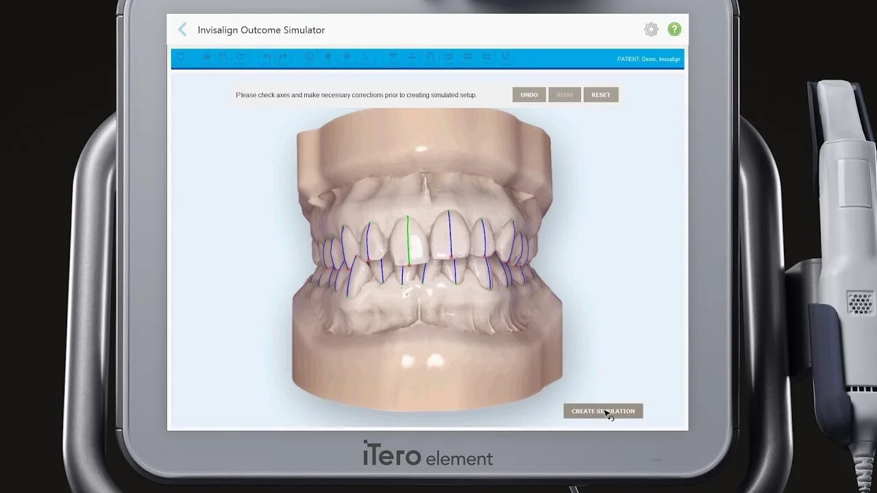 Effective scanning