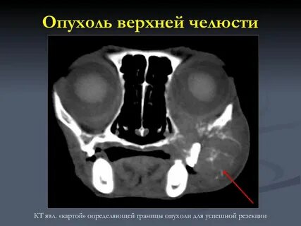 Кт верхней