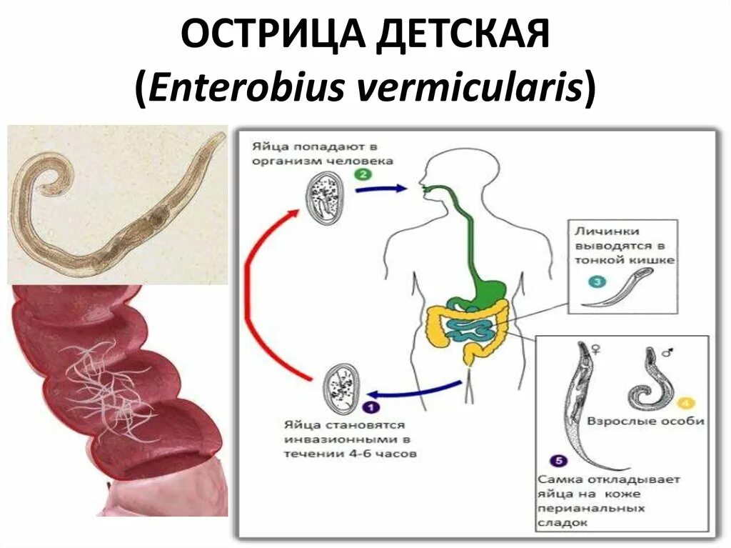 Энтеробиоз острицы у детей. Острица детская размеры. Острица детская размеры. Острица энтеробиоз причины. Enterobius vermicularis жизненный цикл.