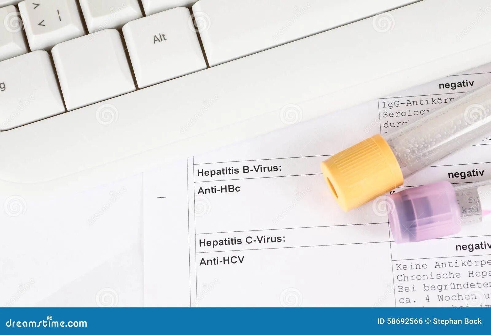 Анти HCV. HCV тест. Кровь на анти-HCV что это. HCV анализ крови что это. Hcv total отрицательный