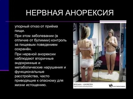 Анорексия что это такое простыми