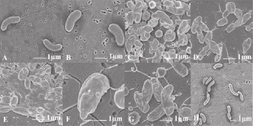 Организм трутовик окаймленный холерный вибрион. Vibrio cholerae микроскопия. Холерный вибрион электронная микроскопия. Фазово-контрастная микроскопия вибрионы холерные. Вибрио холера в контрастной микроскопии.