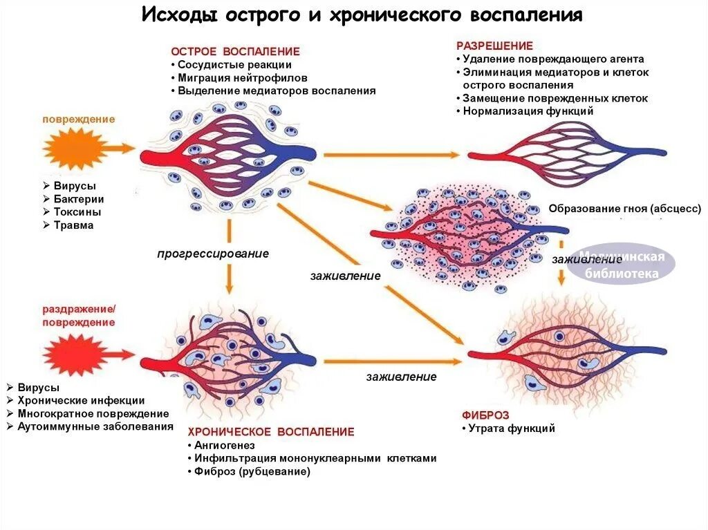 Исходы острого и хронического воспаления. Исходы хронического воспаления. Исходы воспаления патофизиология. Патогенез хронического воспаления. Реакция организма клетки на