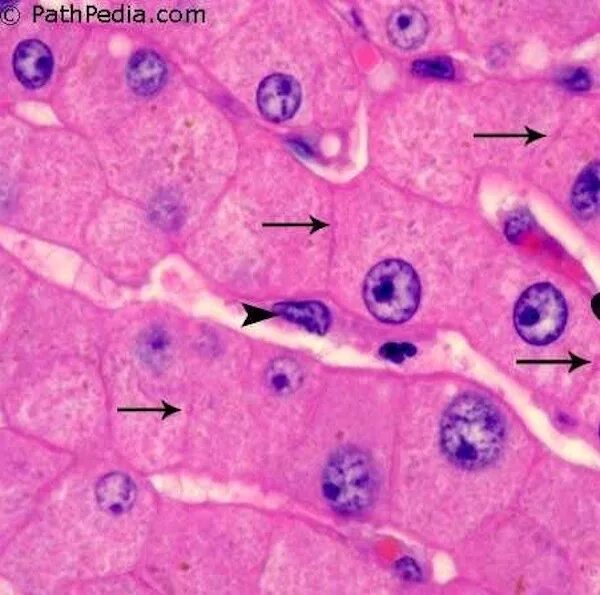 Гепатоциты печени гистология. Клетки печени гепатоциты. Печеночные клетки гепатоциты. Гепатоциты гистология препарат. Клетки печени в дистиллированной воде