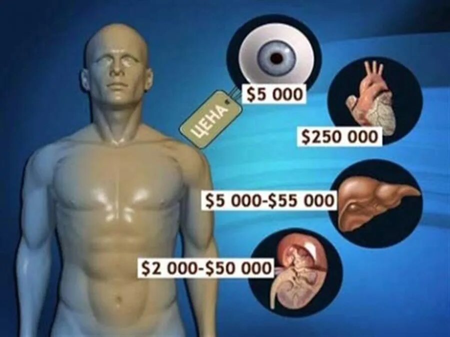 Стоимость органов человека. Продажа человеческих органов.