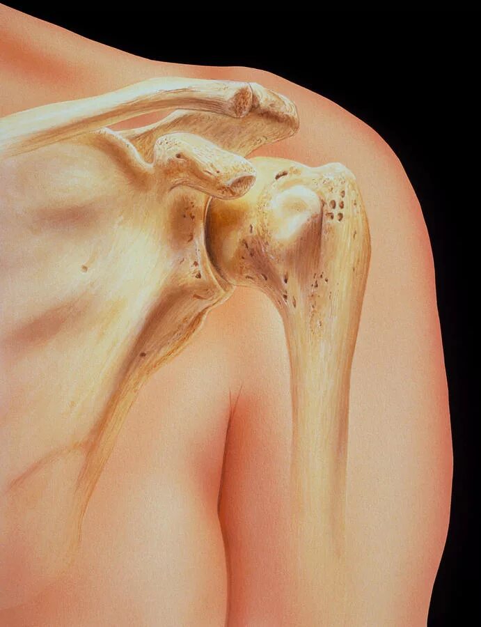 Как выглядит плечо внутри shoulder-pain