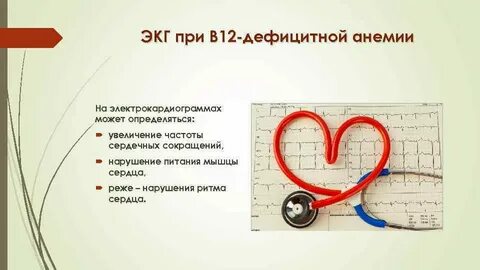 Экг давлении