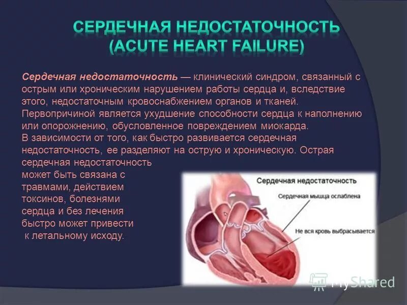 Сердечно-сосудистая недостаточность. Сердечную недостаточность. Заболевания связанные с сердцем. Недостаточность кровообращения в сердце.