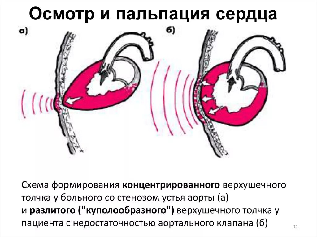 Сопротивление аорты