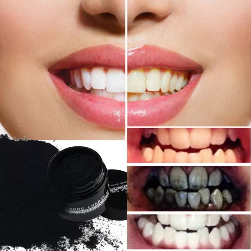 Можно ли чистить зубы углем. Teeth whitening порошок. отбеливание зубов углем. отбеливание зубов активированным углем. отбелить зубы активированным углем.