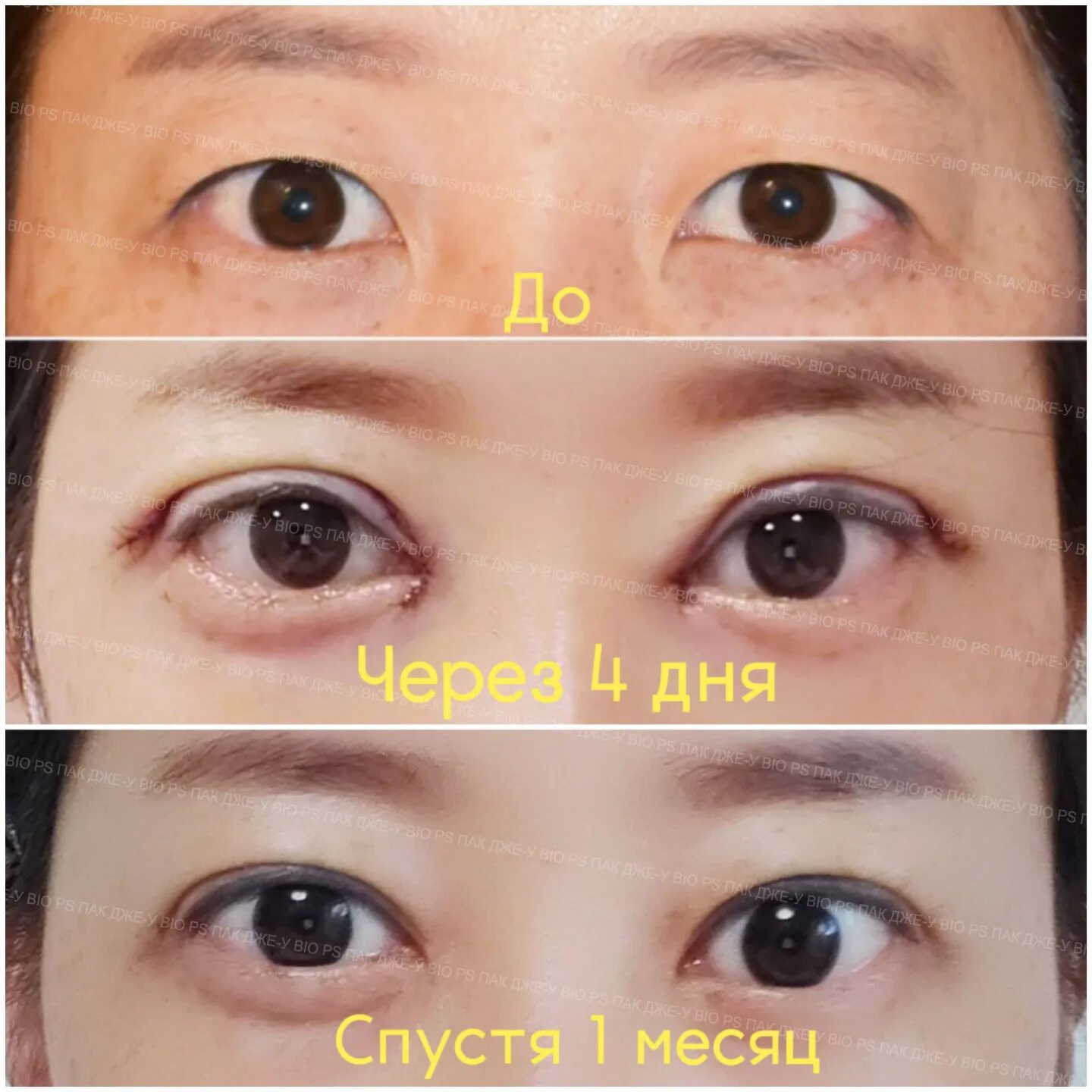 Разрез век