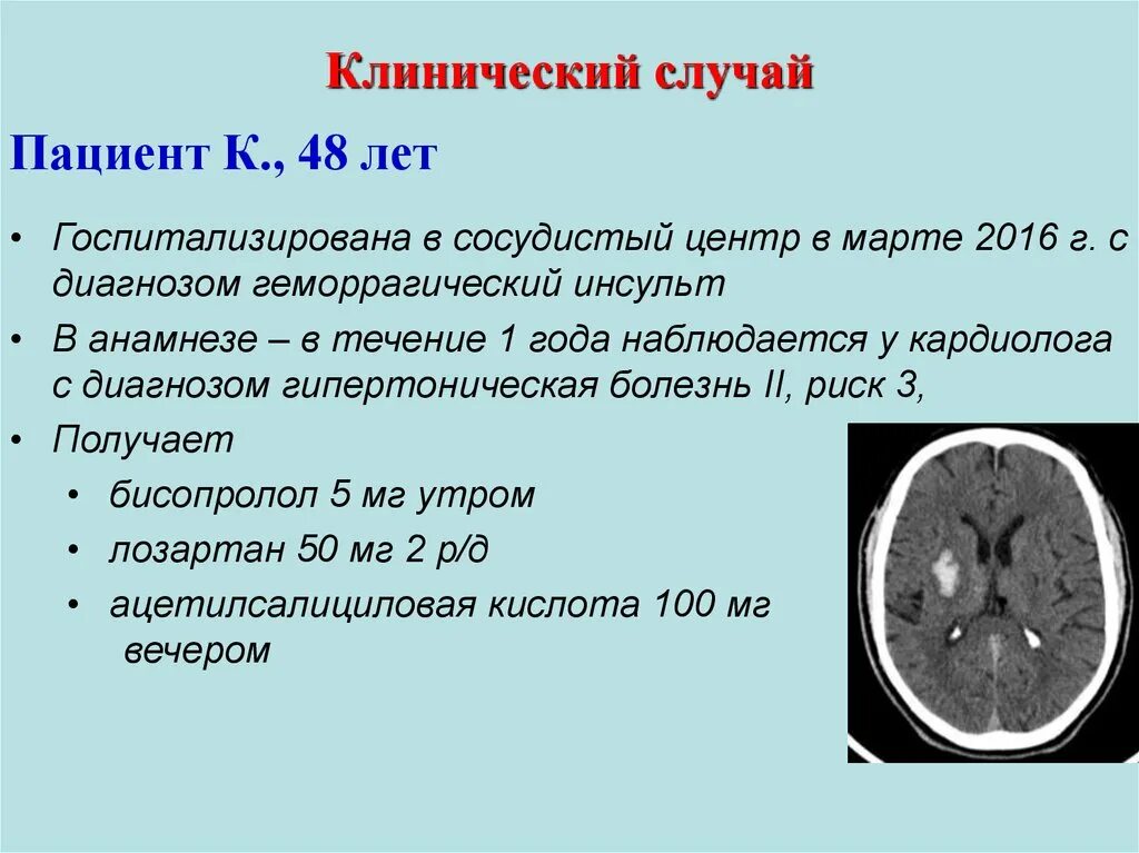 Инсульты задания. Клинические случаи в неврологии. Клинический случай инсульт. Анамнез при геморрагическом инсульте. Клинические случаи в терапии.