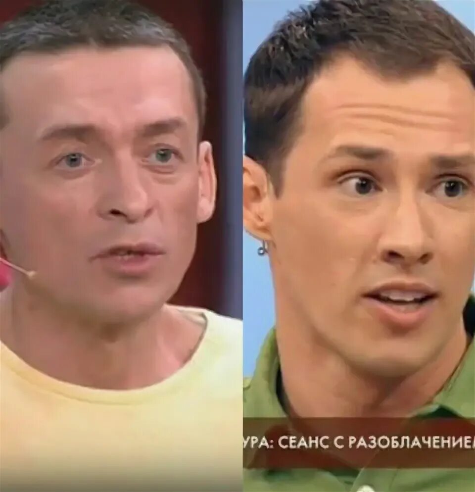 Тимур еремеев до и после пластики Тимур Еремеев Фото До Пластики И После