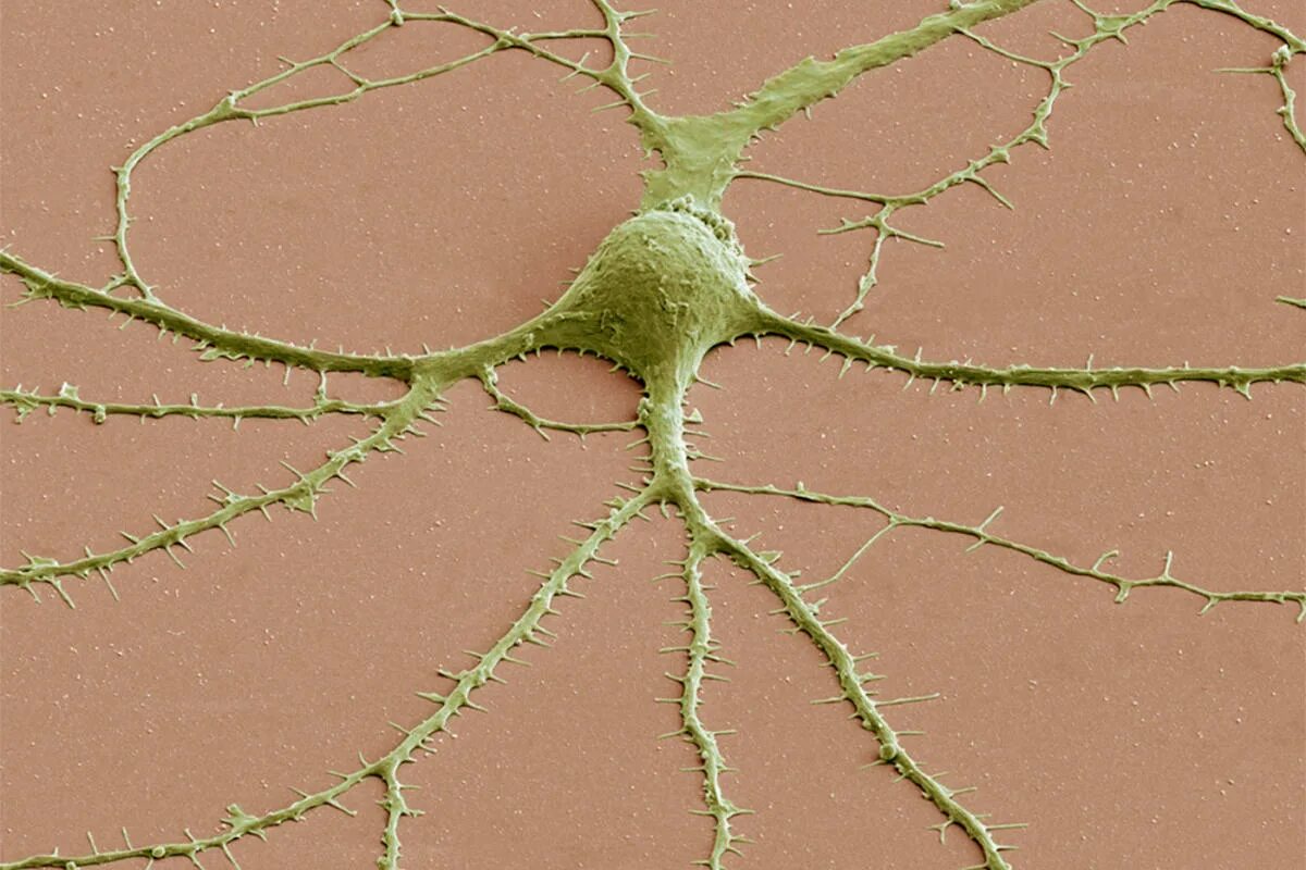 Клетки мозга человека состоят из. Аксон нейрона микрофотография. Нейрон Пуанкаре микрофотография. Аксон нейрона микроскоп. Нейроны мозга под микроскопом.