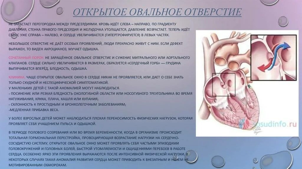 Окно в сердце у ребенка. Врожденный порок сердца овальное окно. Открытое овальное окно в сердце у ребенка нормы. Незаращение овального окна у детей. Открытое овальное отверстие в сердце у ребенка.