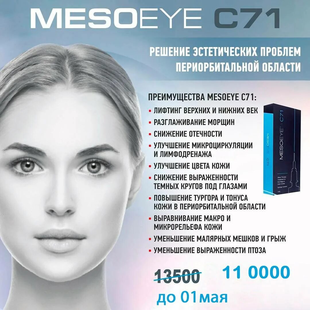 Mesoeye отзывы