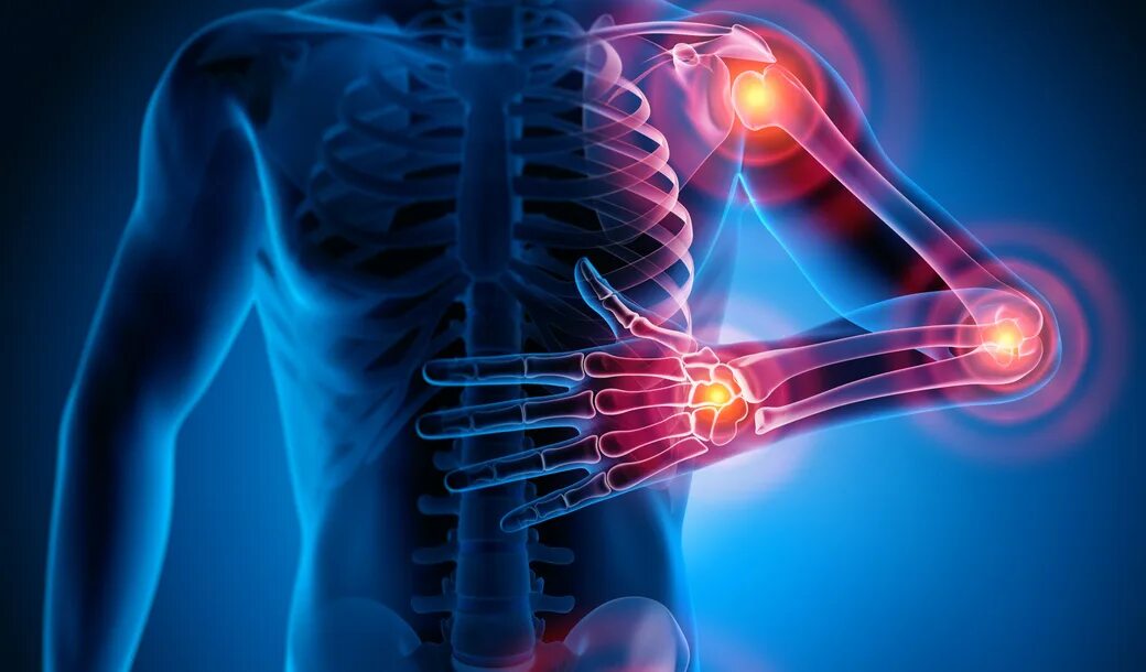Болезни костно-мышечной системы. Ддзп с всд. Опухоли опорно-двигательного аппарата. Хронические заболевания опорно двигательной системы. Опорно двигательный аппарат.