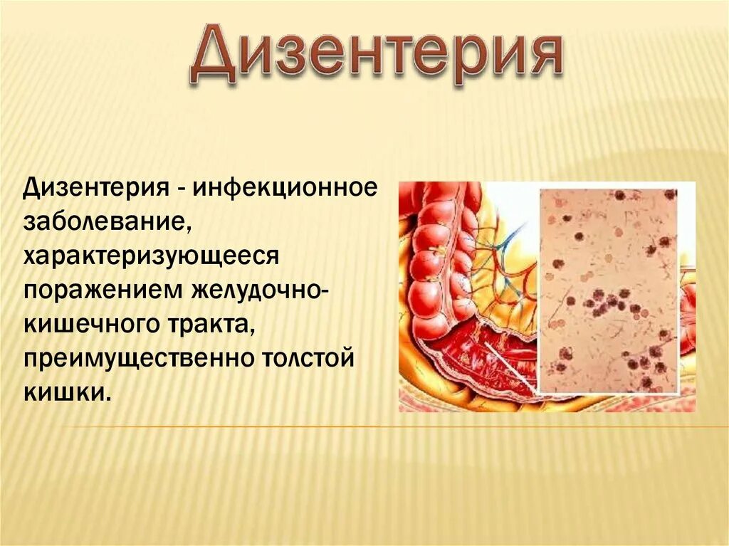 Заболевание дизентерия. Дизентерия инфекционные болезни. Дизентерия симптомы. Дизентерия вирусное заболевание