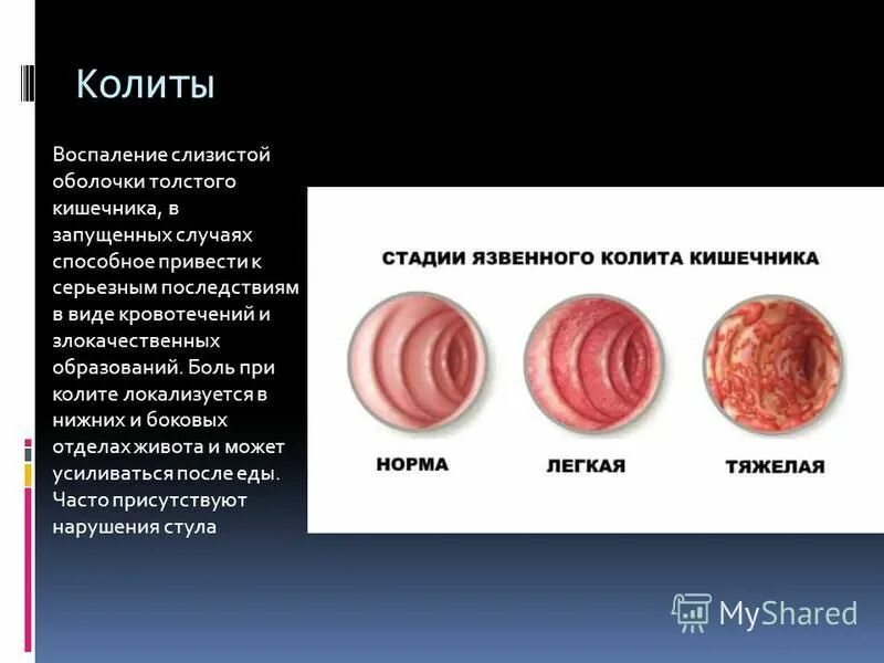 Колем это