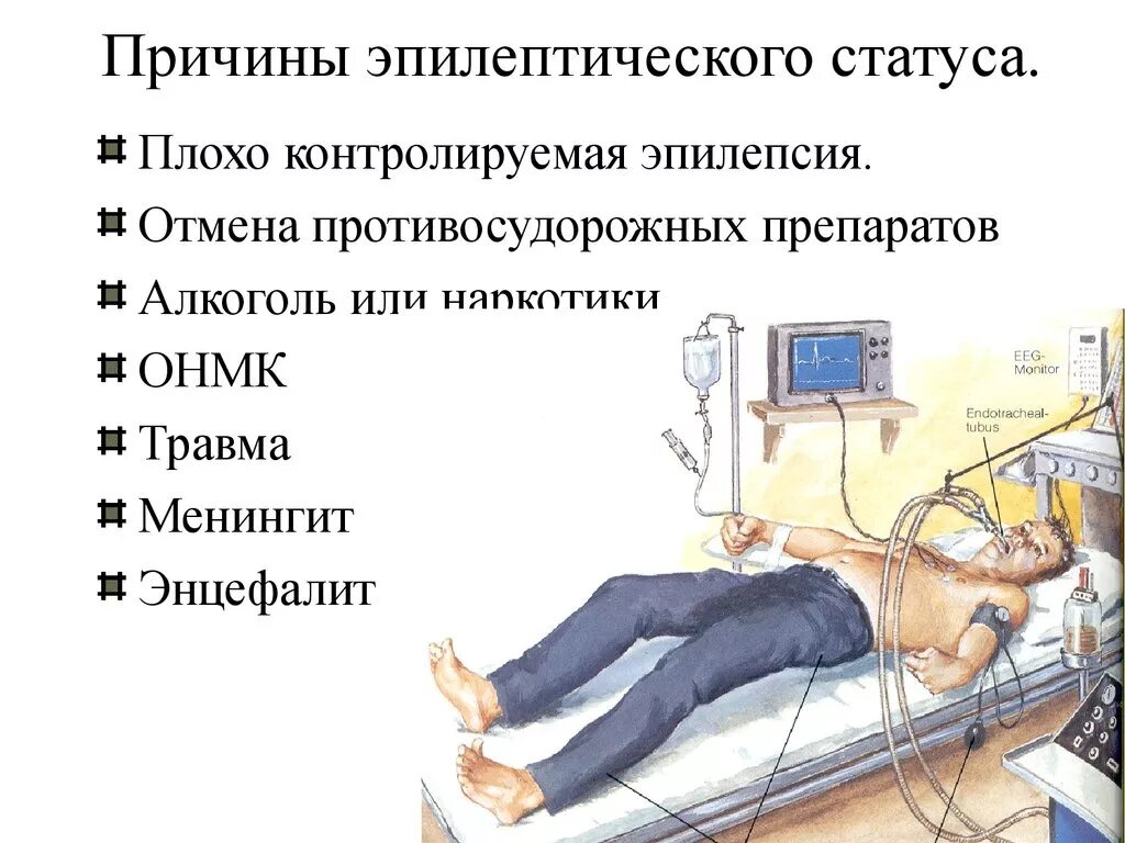 Причины эпилепсия эпилептические припадки. Пмп при приступе эпилепсии. Эпилепсия причины возникновения. Причины развития эпилепсии. Парциальные судороги при эпилепсии.
