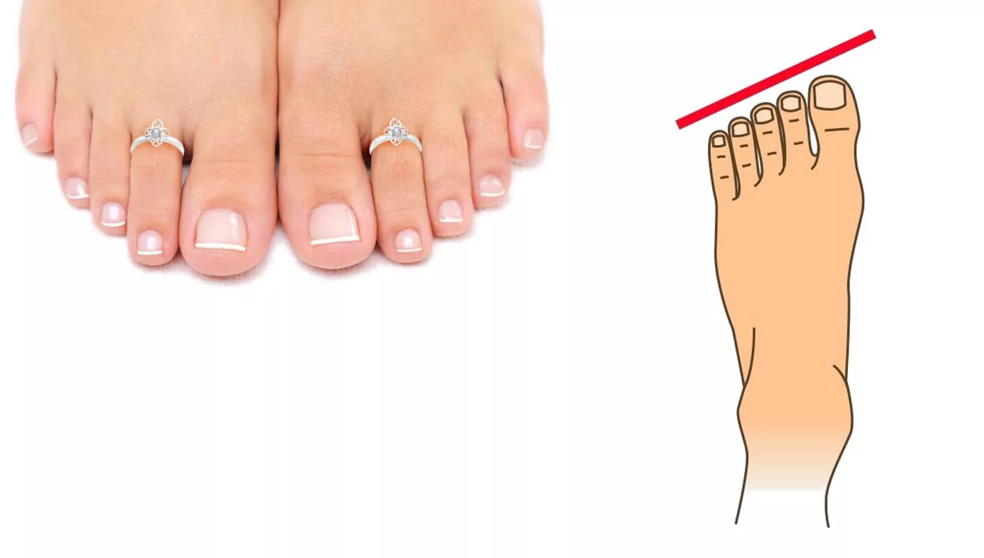 Типы расположения пальцев на ноге. Форма пальцев на ногах у женщин. Форма большого пальца на ноге. Типы форм пальцев на ногах. Форма расположения пальцев на ногах.