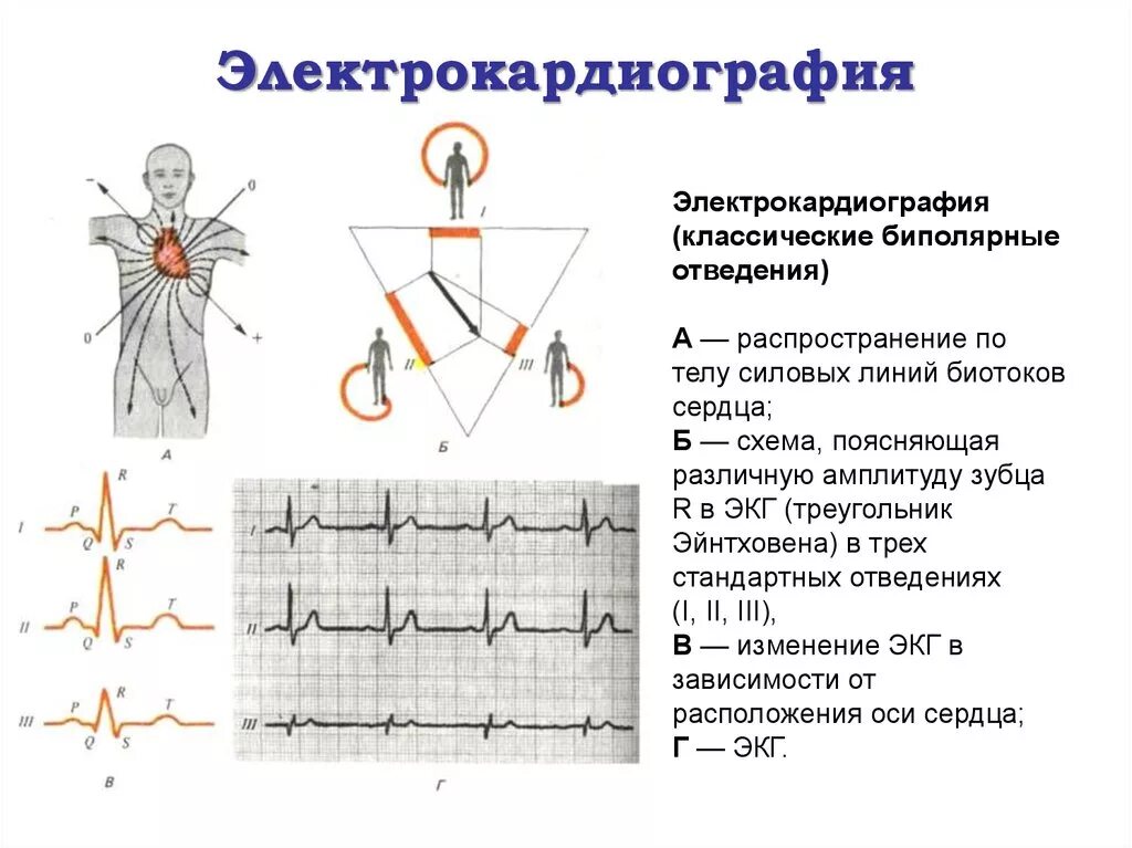 Методика отведения в ЭКГ. Регистрация ЭКГ В 3 стандартных отведениях. Нормальная ЭКГ В 12 отведениях. ЭКГ человека 2 стандартное отведение. Как делают экг взрослым