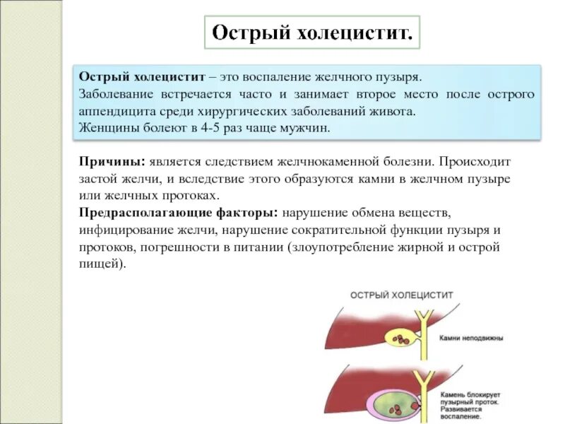 Воспаление желчного холецистит