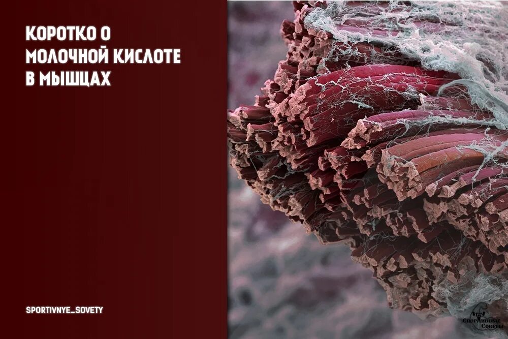 Какая кислота образуется в мышцах. Как выглядит молочная кислота в мышцах. молочная кислота в мышха. молочная кислота в мышцах под микроскопом. микротравмы мышц после тренировки.