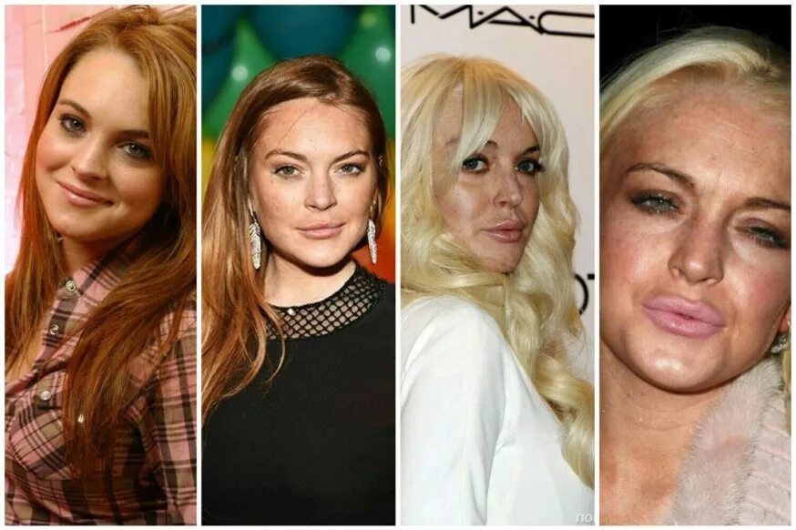 стал выглядеть. знаменитости в возрасте. звезды с каре до и после. майли сайрус до и после пластики. стал выглядеть.