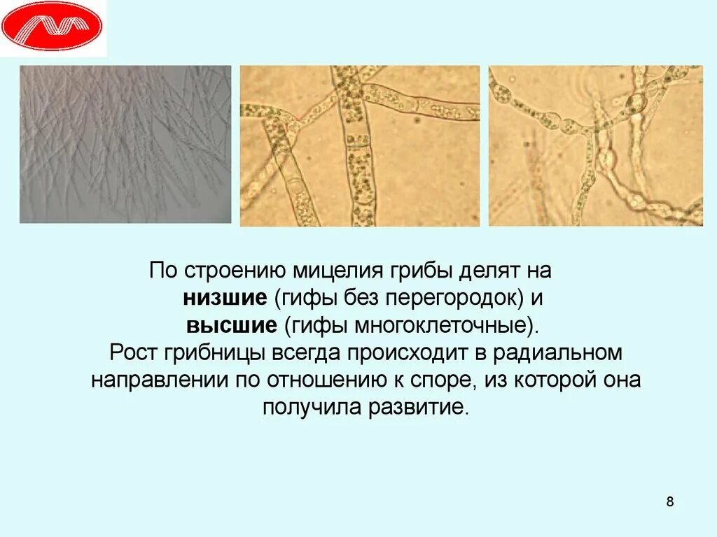 Мицелий грибов представлен одноклеточными. Строение мицелия низших грибов. Строение мицелия высших и низших грибов. Строение мицелия. Мицелий с перегородками.