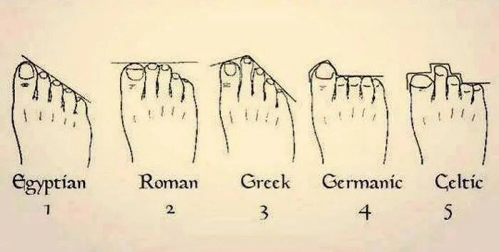 Типы стопы человека. Форма пальцев на ногах и происхождение человека. Типы расположения пальцев на ноге. Типы форм пальцев на ногах. Название формы пальцев на ноге.