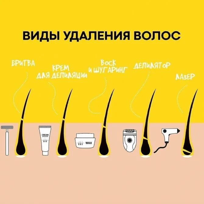 Депиляция бывает