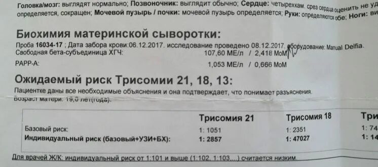 Риски трисомии нормы таблица по возрасту Трисомия 13 расшифровка