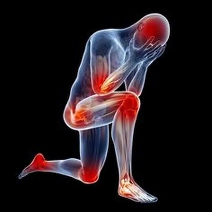Хондрома - доброкачественная опухоль кости: причины, симптомы и лечение MedAbout