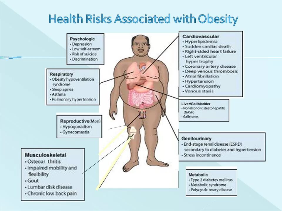 Health risks. Ожирение и гипогонадизм. Ожирение при гипогонадизме. Obesity classification.