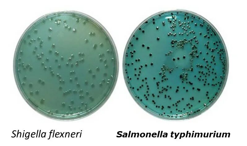 Spp salmonella spp shigella spp