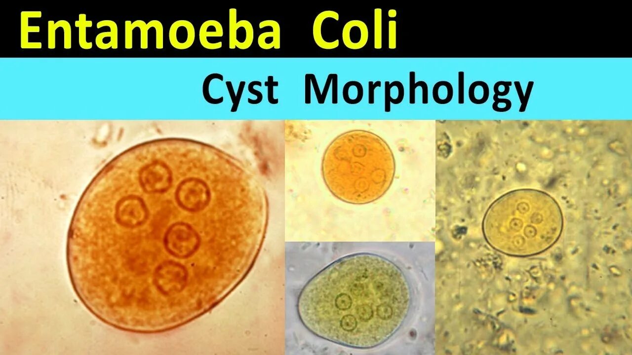 Entamoeba coli циста. Цисты Entamoeba coli 0 1. Цисты энтамеба коли. Entamoeba coli кариосома. Entamoeba coli в кале