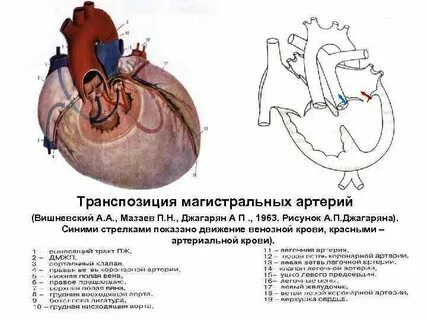 Впс плода