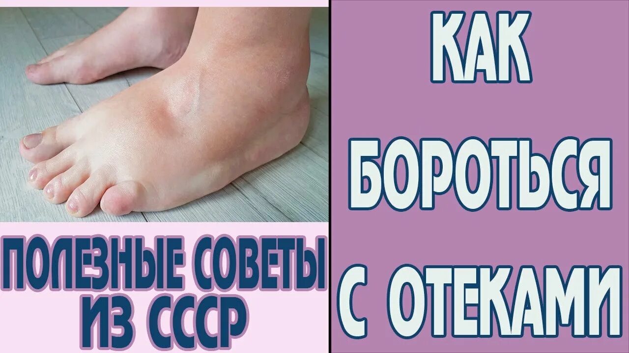Senior woman swollen feet and leg фотография Stock Adobe Stock