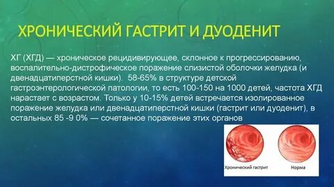 Дуоденит желудка лечение у взрослых препараты