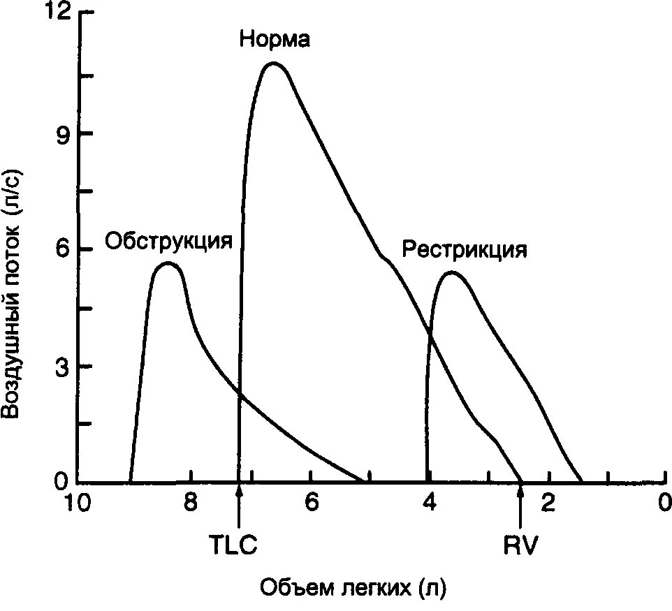 Спирограмма обструктивный тип. Спирометрия (показатели функции внешнего дыхания. Спирография обструкция. Фвд обструкция. Спирография при очаговой пневмонии.