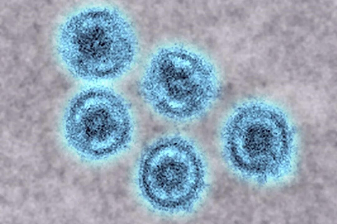 Вирус Эбола под микроскопом. Вирус Covid-19. Рекомбинантный вирус это. Вирус гриппа. Штаммы коронавируса мире