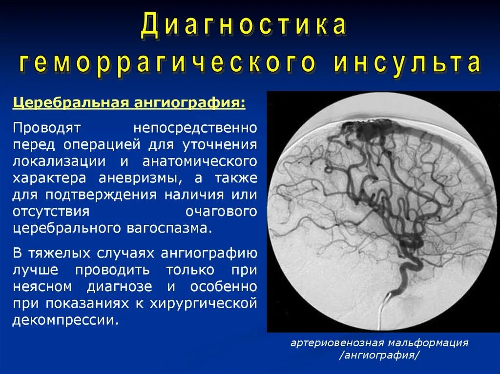 Кровоизлияние ствола мозга. Геморрагический инсульт этиология патогенез клиника диагностика. Патогенез внутримозгового кровоизлияния. Геморрагический инсульт этиология. Геморрагический инсульт презентация.