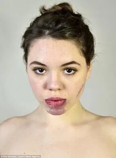 Лена с пятном на лице