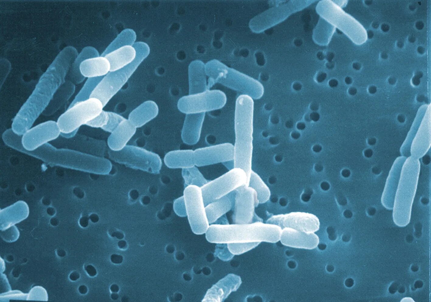 Палочка бифидобактерии. Lactobacillus reuteri. Палочковидные молочнокислые бактерии. Лактобактерии микробиология. Lactobacterium reuteri.