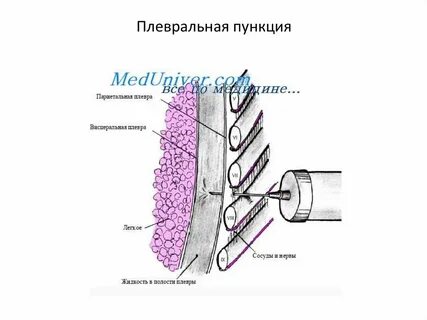 Нервная жидкость