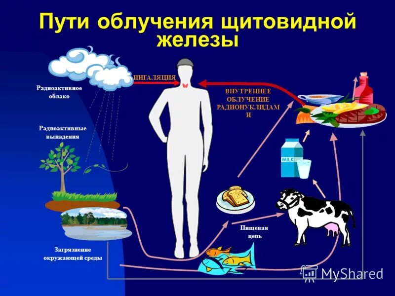 Лучевая терапия щитовидной железы. Лучевая терапия щитовидной железы. Влияние железа на щитовидную железу. Радиотерапия щитовидной железы. Радиотерапия щитовидной железы.