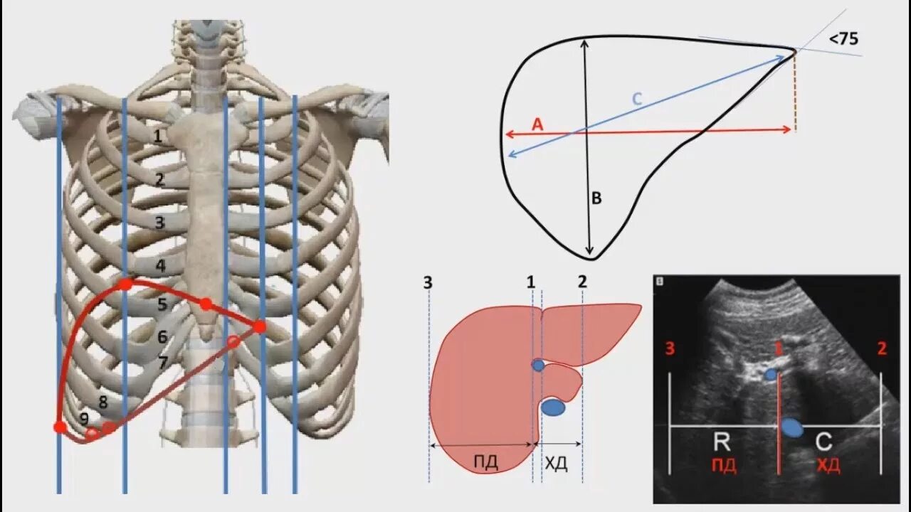 Размеры печени на узи у мужчин. Скелетотопия печени анатомия. Топография печени скелетотопия. Скелетотопия печени схема. Скелетотопия печени нижняя граница.